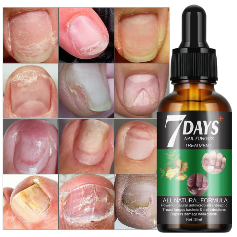 Traitement des ongles